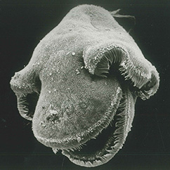 Larva of a ribbon worm. Scanning elektron mikroscopy. Length ca. 1/5 mm.  Photo Claus Nielsen .